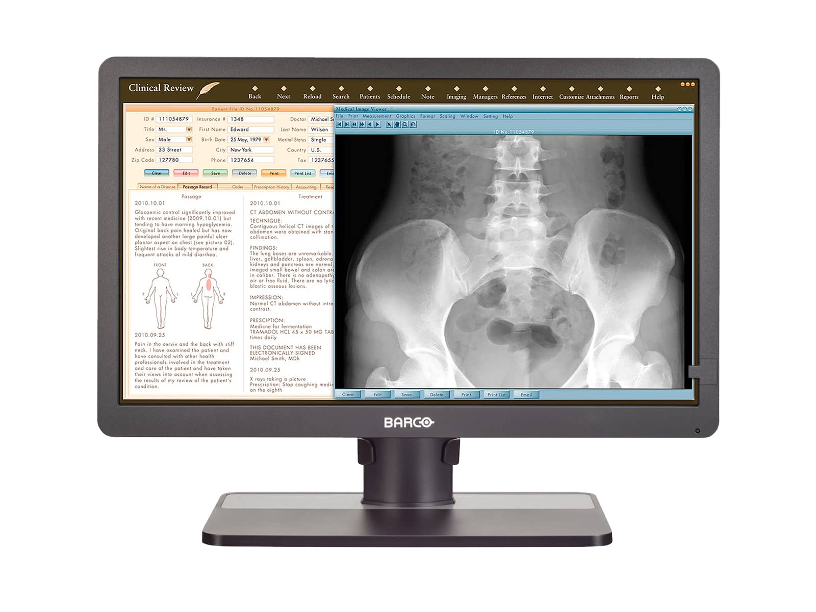 Barco Eonis MDRC-2324 SNIB 2MP 24" Clinical Review LED Monitor Monitors.com 