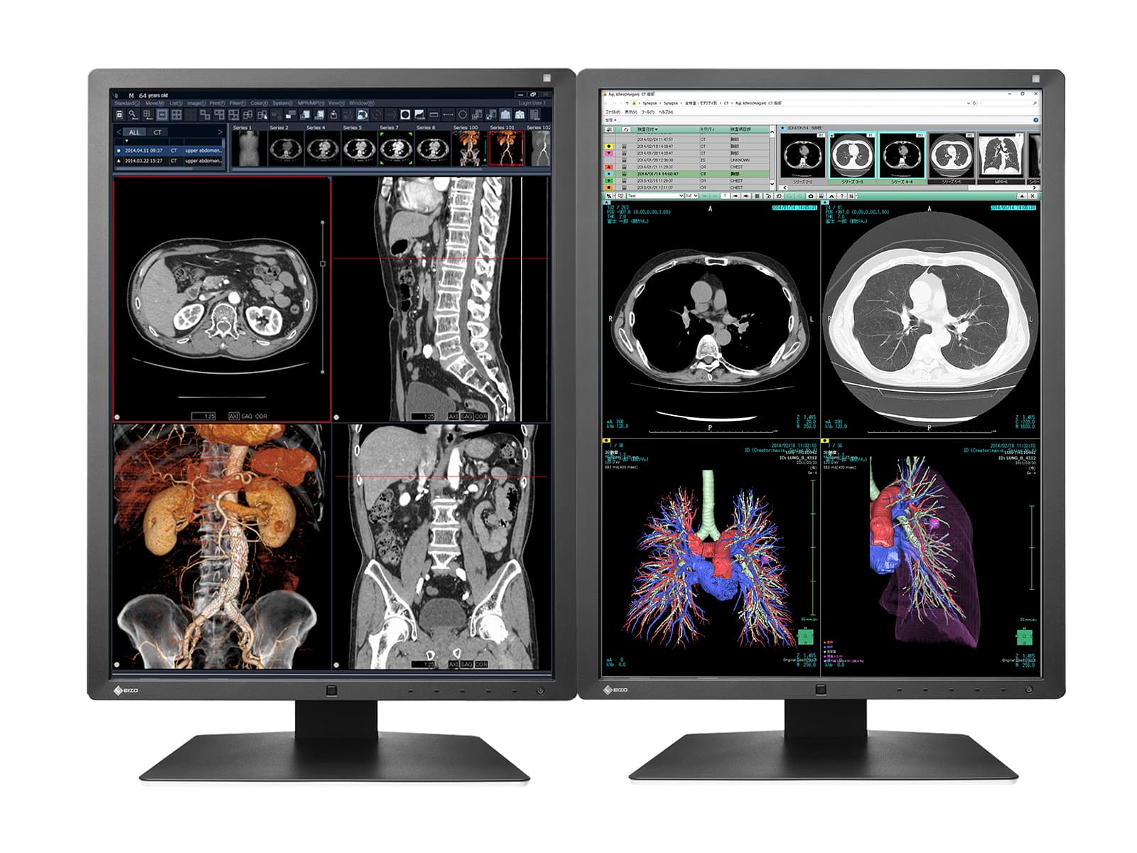 Eizo RadiForce RX250 2MP 21" Color LED Medical Diagnostic Radiology Display Monitor (RX250-BK) Monitors.com 