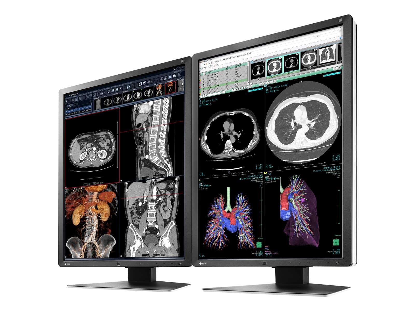 Eizo RadiForce RX250 2MP 21" Color LED Medical Diagnostic Radiology Display Monitor (RX250-BK) Monitors.com 