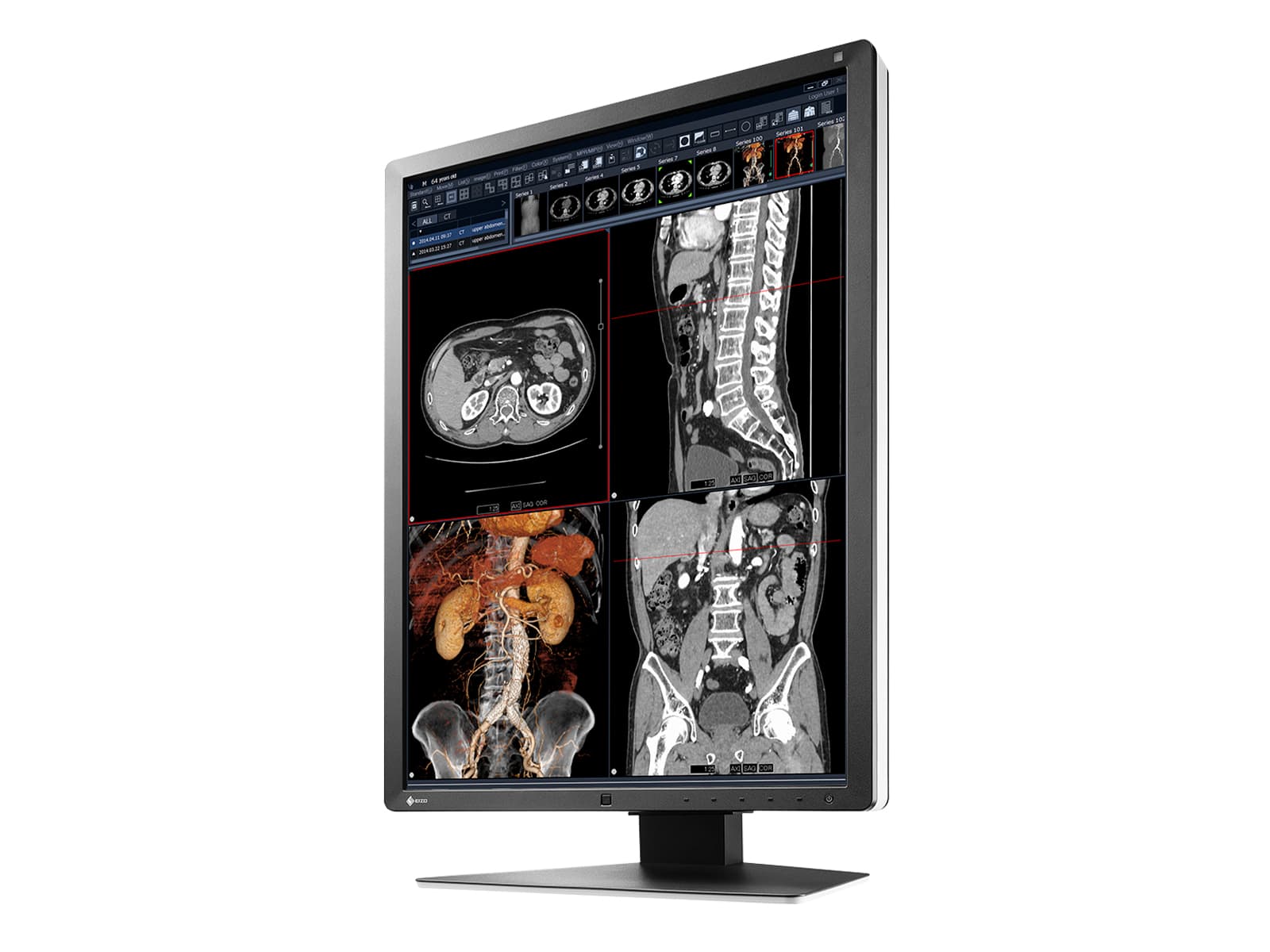 Eizo RadiForce RX250 2MP 21" Color LED Medical Diagnostic Radiology Display Monitor (RX250-BK) Monitors.com 